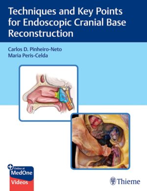 Techniques and Key Points for Endoscopic Cranial Base Reconstruction With Videos