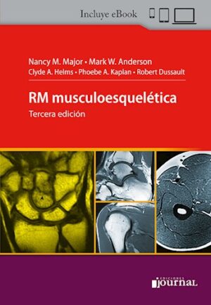 RM MUSCULOESQUELETICA