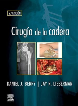 Cirugía de la cadera (Spanish Edition)