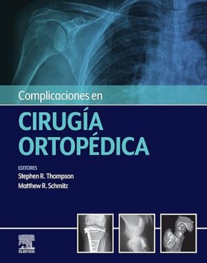 Complicaciones en cirugía ortopédica: Medicina deportiva (Spanish Edition)