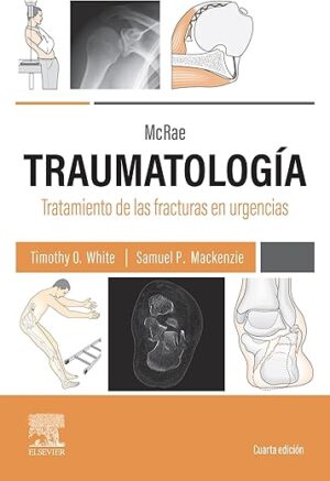 McRae. Traumatología. Tratamiento de las fracturas en urgencias (Spanish Edition)