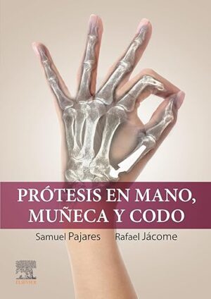 Prótesis en mano, muñeca y codo (Spanish Edition)