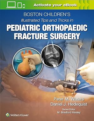 Boston Children’s Illustrated Tips and Tricks in Pediatric Orthopaedic Fracture Surgery 1st Edition